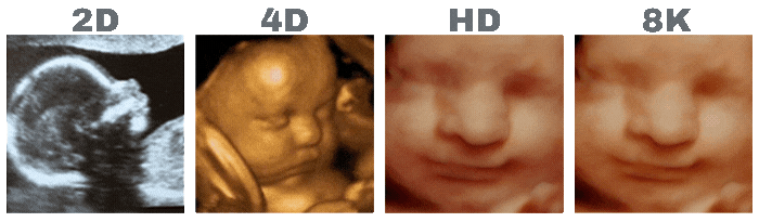 2d ultrasound 3d ultrasound 4d ultrasound hd ultrasound comparison